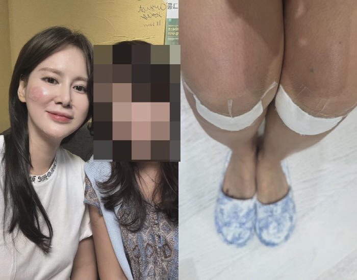 Ahn Jung-hwan ♥ Lee Hye-won was in a fall accident Get off your head. Your face and legs are split