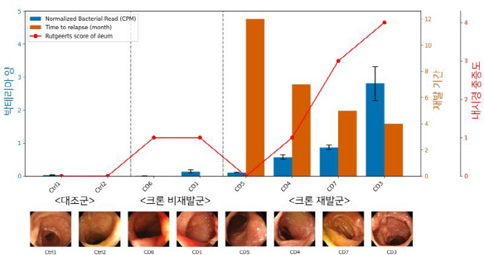 Development of technology for simultaneous analysis of microorganisms and human genes in intestinal tissues...Expectations for predicting Crohn's disease prognosis and treatment strategies