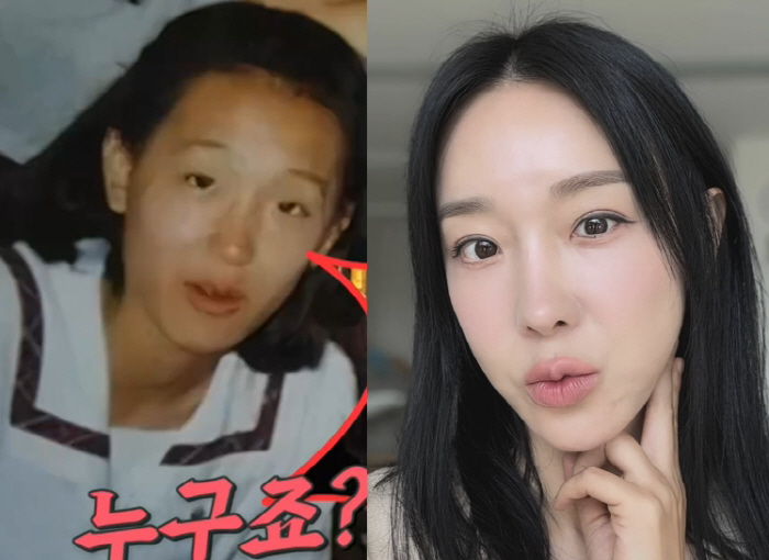 Lee Ji-hye has a younger brother who died on another face so that he can't reveal his picture before plastic surgery