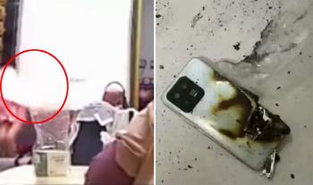 The smartphone explosion in hand...a three-year-old serious burn