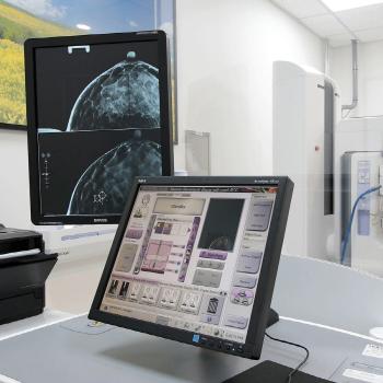 Early detection of hereditary breast cancer, BRCA mutation is key