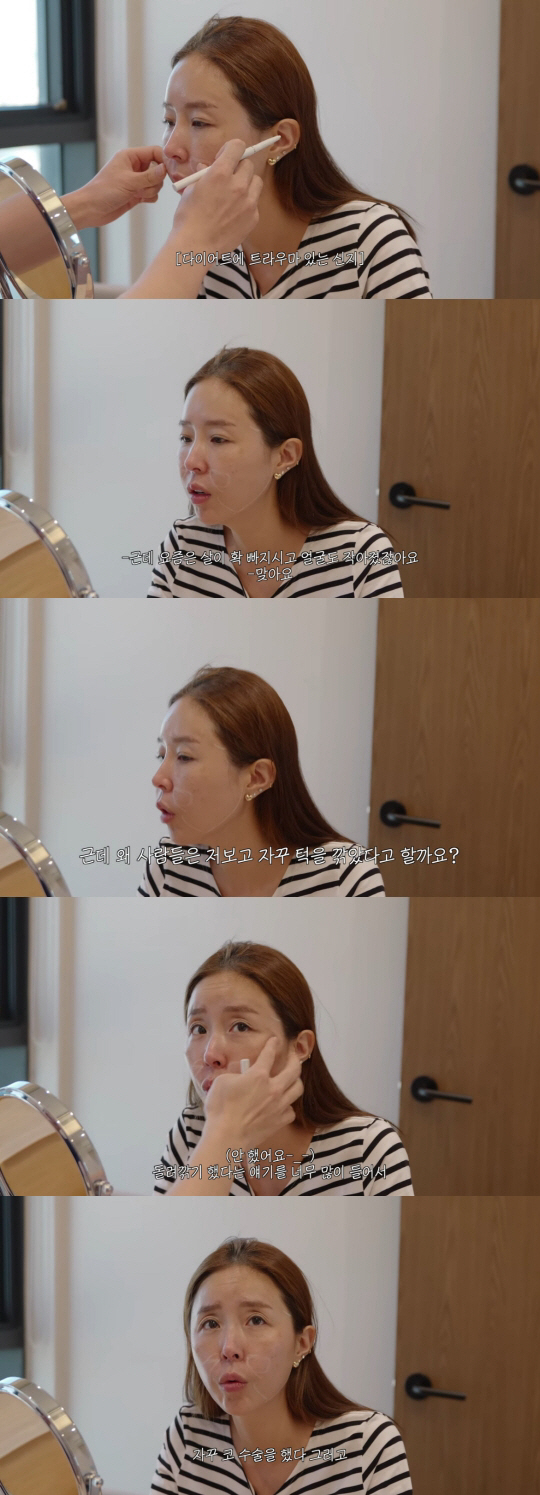 Shinji revealed the suspicion of continued plastic surgery. She's cheekbones, shaved her chin, and had nose surgery. It's unfair