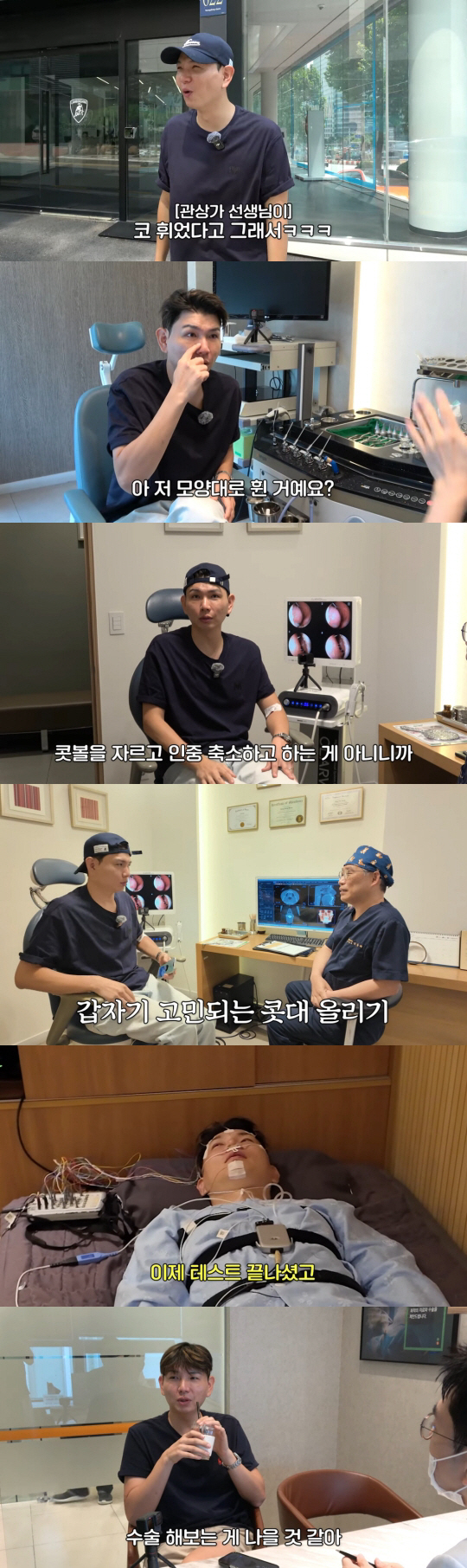 Hong Hyun-hee ♥ Jason will have nose surgery. His face will change completely when he says nose bridge (Hong Sun-hee TV)