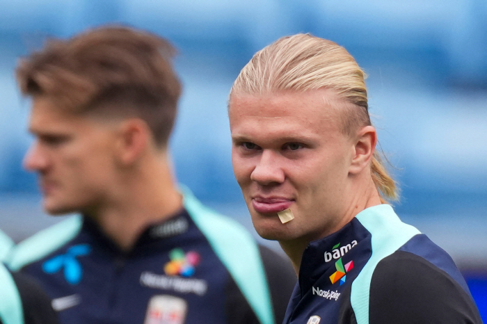 What's wrong with her lips?Who hit you? Manchester City's one-top lip injury update ahead of Manchester United match