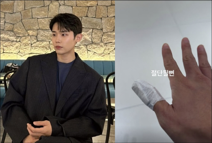 Airplane accident Ailee year ♥ Choi Si-hoon almost got his finger cut off with a dizzying injury