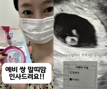 40-year-old Oh Cho-hee, miscarriage after a month..0.4% chance identical twin pregnancy is a miracle
