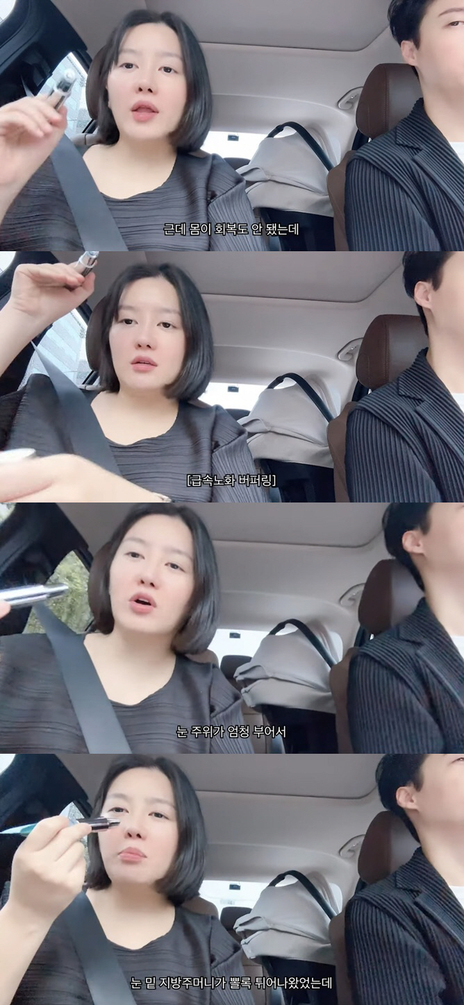 Lee Soo-min Loses 26kg, Sudden Ageing After Giving Birth, Pockets of Fat Under the Eyes pop out