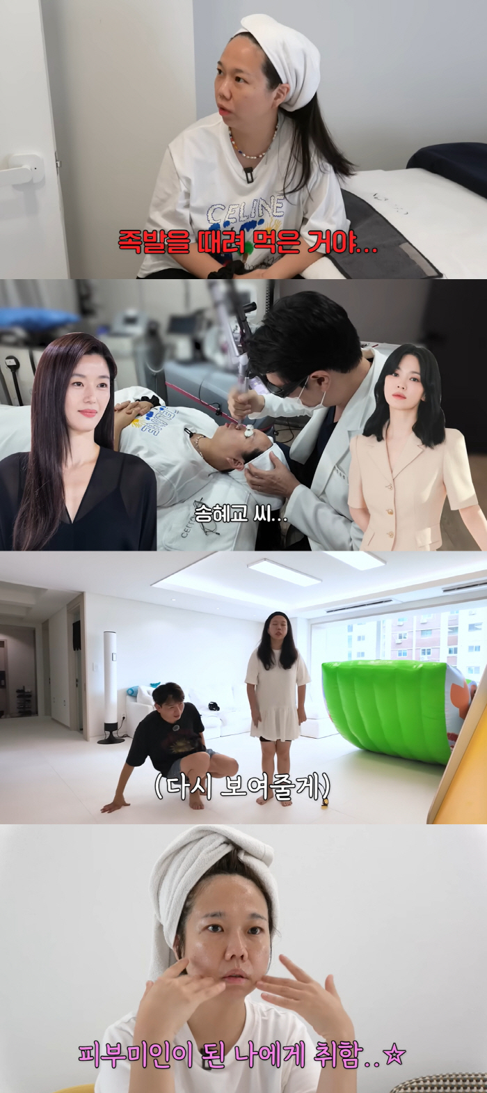 Hong Hyun-hee quit eating for 3 days and can't recognize her half-face. I want to be Jun Ji-hyun and Song Hye-kyo