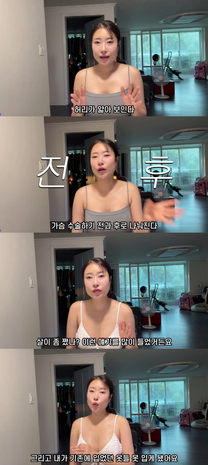 100 million Lee Se-young A Cup → D Cup for plastic surgery. After breast surgery, they can't sleep on the side and say they've gained weight