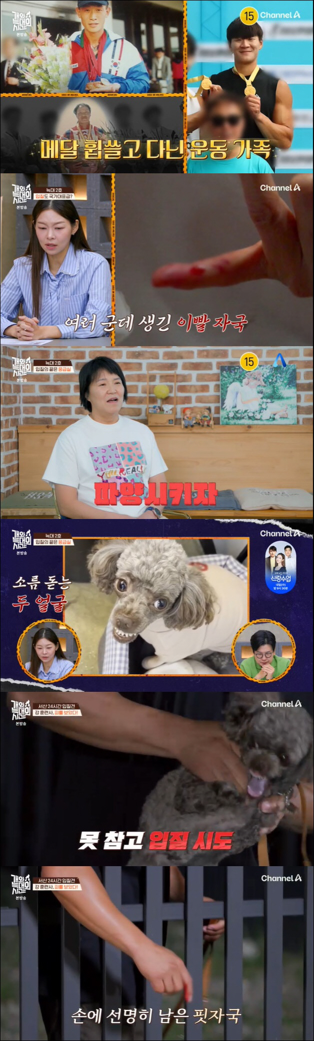 Kang Hyung-wook got into a dog bite accident...Should I euthanize my hands with blood