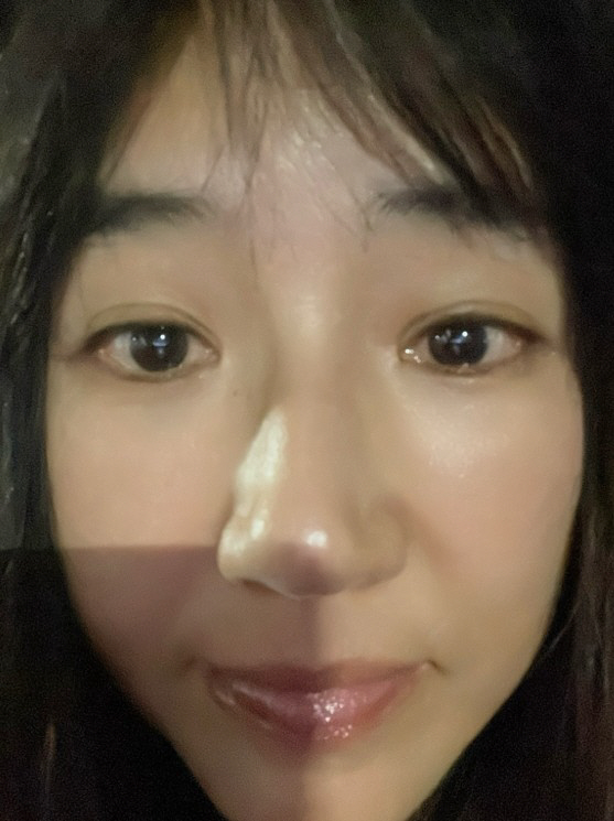 Type 1 Diabetes Yun Hyun-sook, Health Abnormal Signs Again...Should I do a CT scan or a blood test
