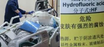 Step on bone-melting water while walking a woman in her 50s...He's dead in five days
