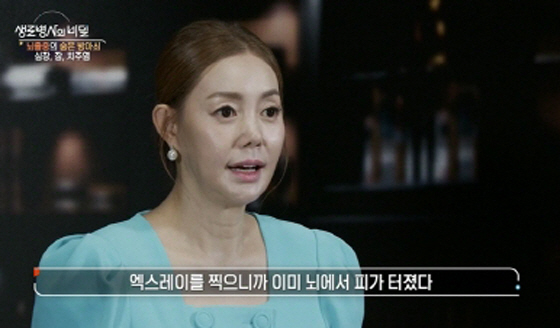 Singer Park Gyu-ri diagnosed with cerebral hemorrhage at the age of 34, causing blood to burst from the brain, which is a life emergency (secret of a life-long soldier)