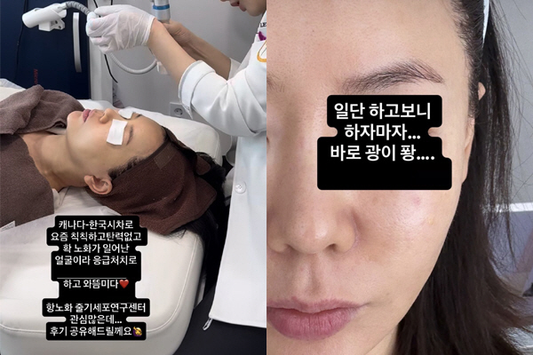 Ahn Sun-young, Korea ↔ Canada is aging..'Restoring radiance with emergency procedures'