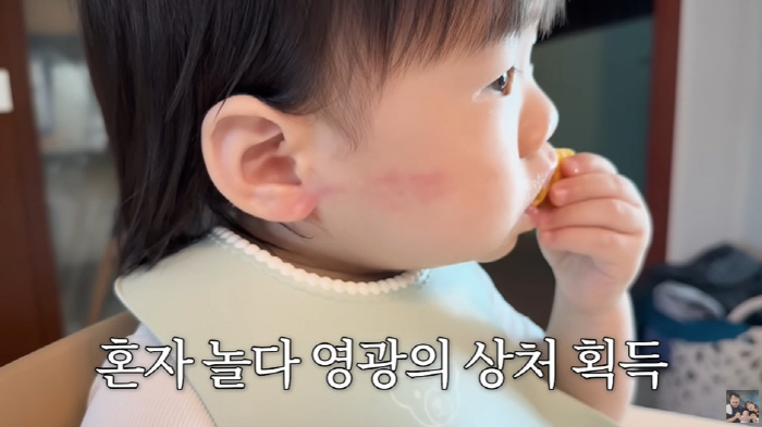 Lee Eun-hyung ♥ Kang Jae-joon won a wound while playing alone with a red swollen cheek wound for 13 months (KiUTV)