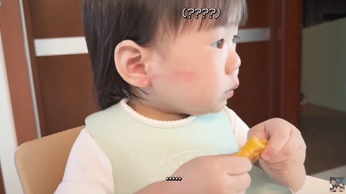 Lee Eun-hyung ♥ Kang Jae-joon won a wound while playing alone with a red swollen cheek wound for 13 months (KiUTV)