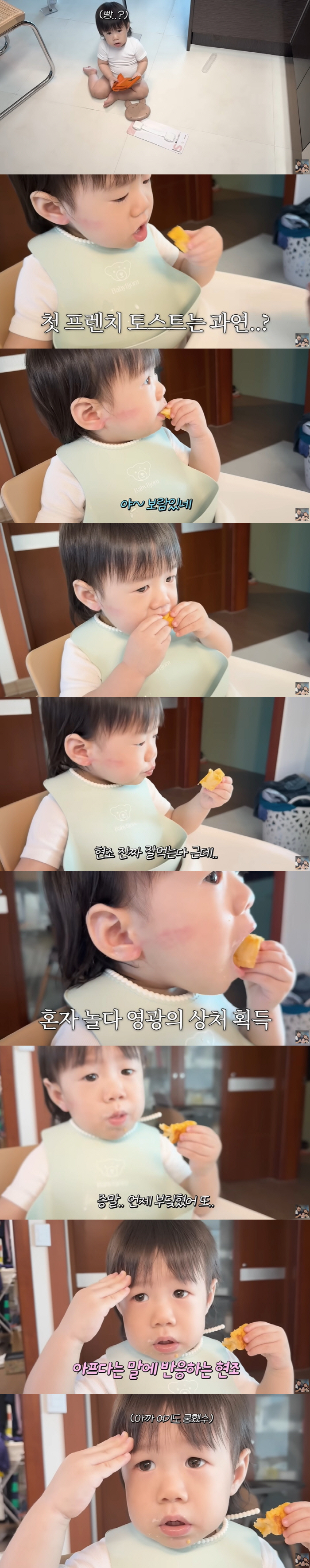 Lee Eun-hyung ♥ Kang Jae-joon won a wound while playing alone with a red swollen cheek wound for 13 months (KiUTV)