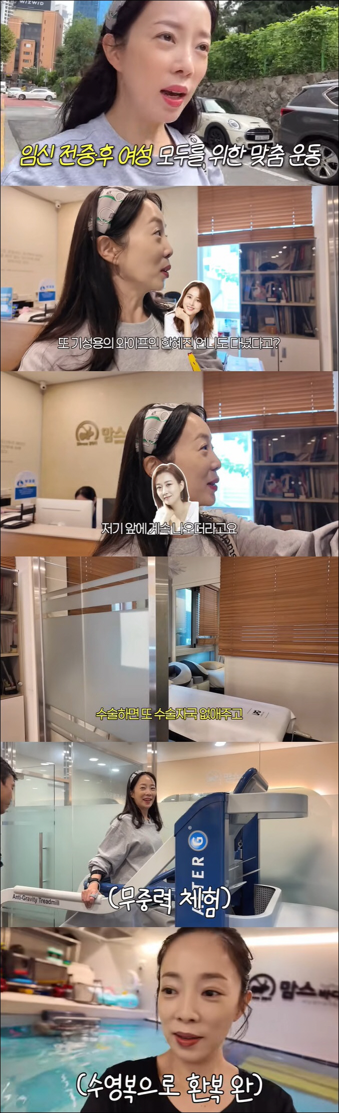 Jang Yoon-jung and Han Hye-jin...How to manage the luxury of pregnant women celebrities. Get rid of open surgical scars