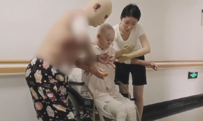 A gas explosion in a cigarette..A burned-out model with a influencer turned her life around.