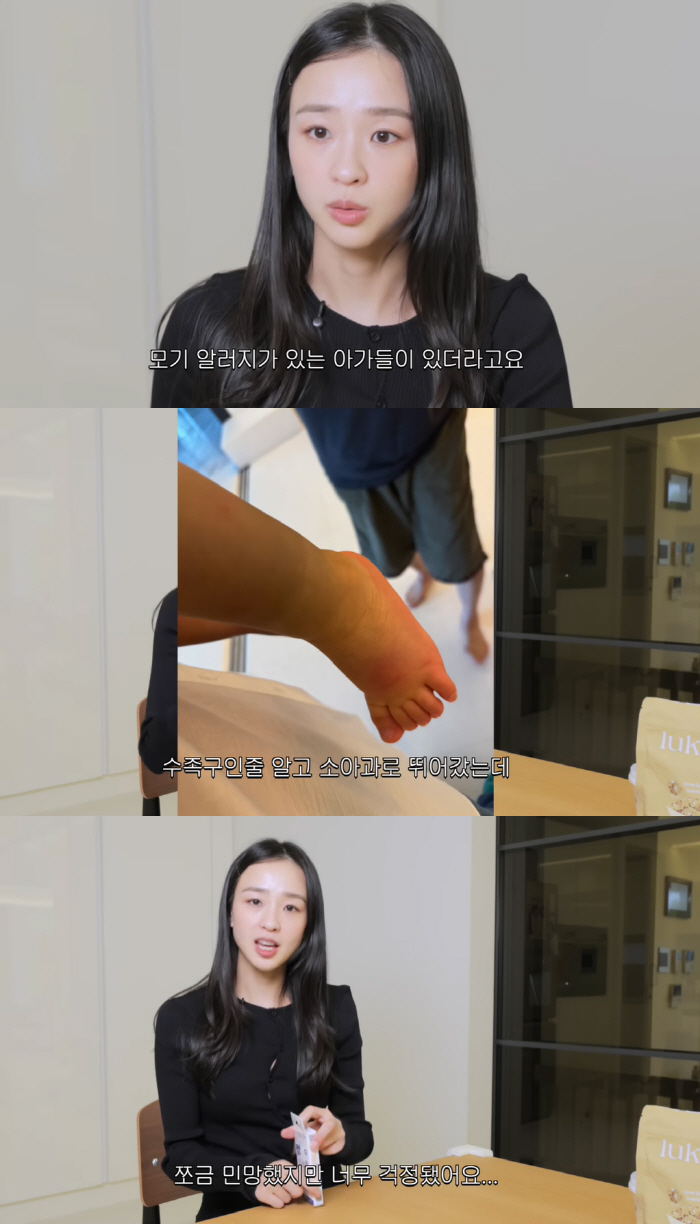 Son Yeon-jae, 'Inflammation and pus from 20 bites on the face'.. Mosquito allergy, 'Heart throbbing.'