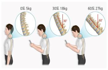You Bowing Down With Your Smartphone Calls Turtle Neck Syndrome