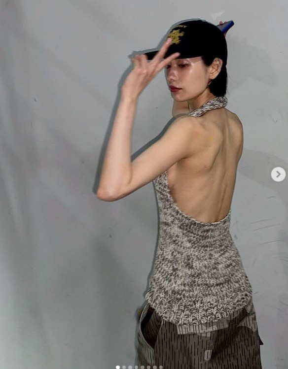 Nana Shares Hopeful Message After Erasing Most Tattoos