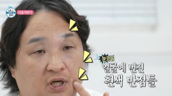 Koo Sung-hwan, unable to cure tears while being treated for incurable diseases. There is no guarantee that it will heal