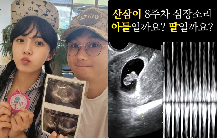 Kang Eun-bi, a 40-year-old natural pregnant woman, is touched by the sound of her first heart, small and precious, and moved by her palpitations
