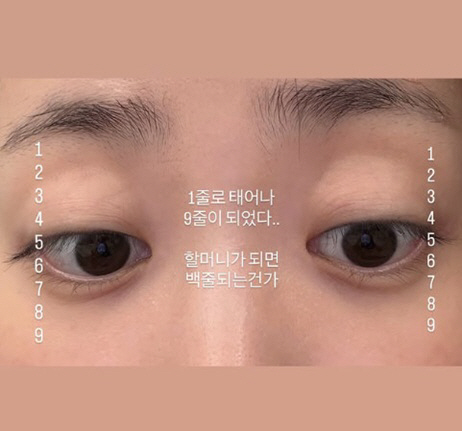 Park Soo-hong ♥ Kim Daye confesses her concerns about double eyelid wrinkles in 9 lines. What if she becomes a grandmother?