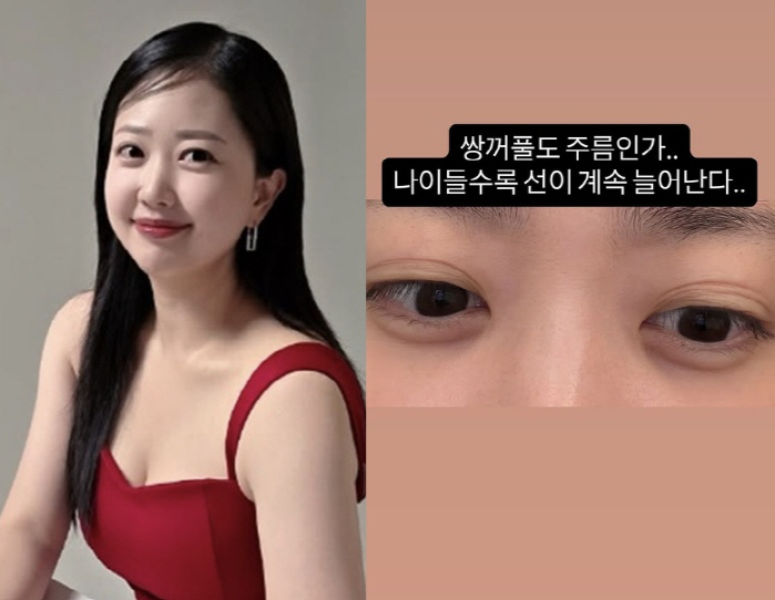 Park Soo-hong ♥ Kim Daye loses 30kg and one line of shock is 9 lines due to the increased wrinkles