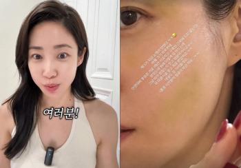 Choi Hee, a negative factor in the treatment of the aftereffects of facial paralysis...To the point where my face is puffed up