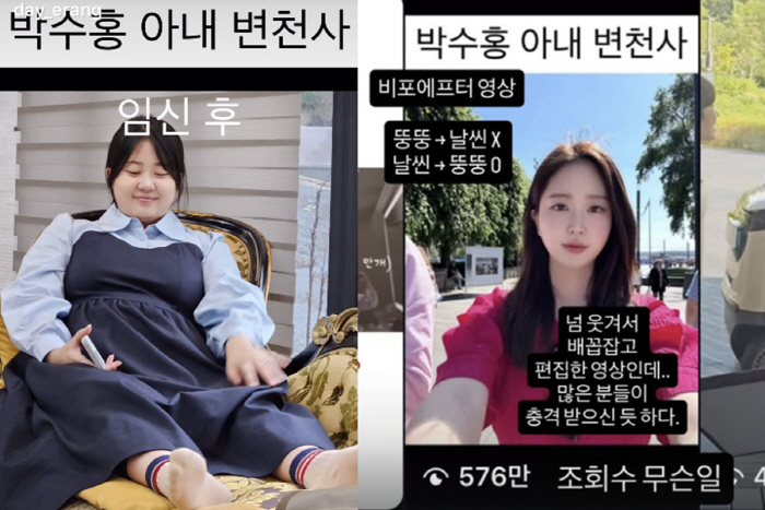 Park Soo-hong ♥ Kim Daye's 30kg Before and After video all shocked 5.76 million views