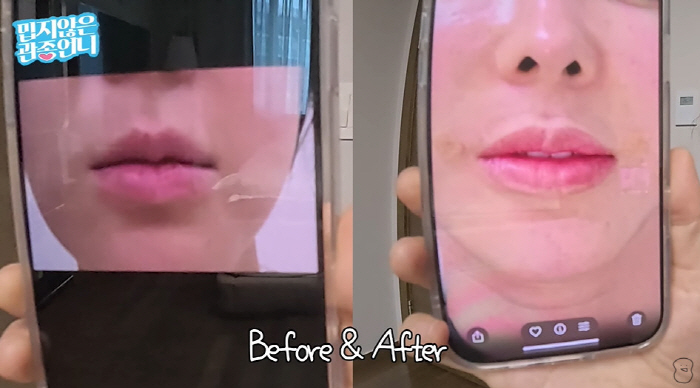 46-year-old Lee Ji-hye confesses that thread lifting  lip tattoos became clear and decided on the procedure (Gwan Jong-un's sister)