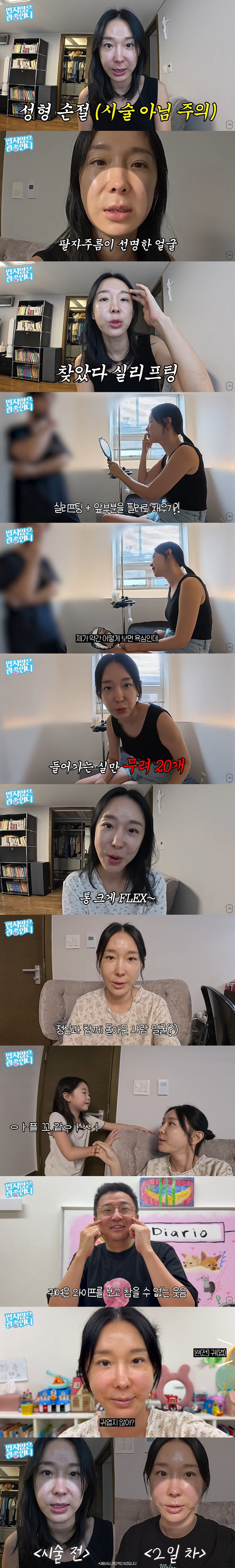 46-year-old Lee Ji-hye confesses that thread lifting  lip tattoos became clear and decided on the procedure (Gwan Jong-un's sister)
