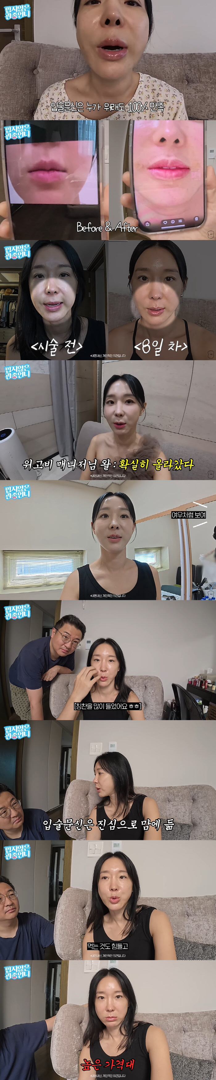 46-year-old Lee Ji-hye confesses that thread lifting  lip tattoos became clear and decided on the procedure (Gwan Jong-un's sister)