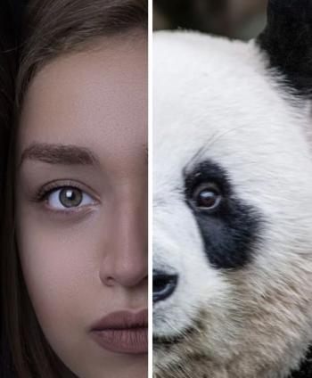 Dark circles that thicken like pandas even if you rest well, what's the solution?