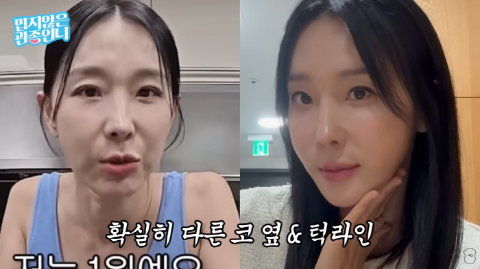 Lee Ji-hye, 45, changed her face after thread lifting♥ Moon Jaewan has become so pretty