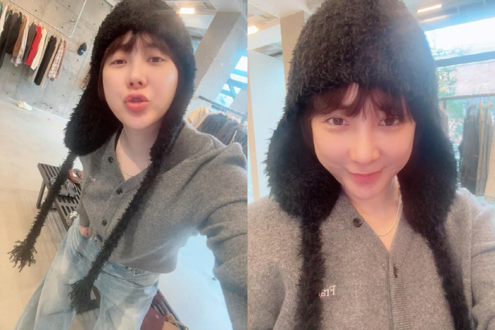 Seo In-young is confident in increasing 10kg and side effects of plastic surgery..It's good to see Lee Jihyun, too. Cheering