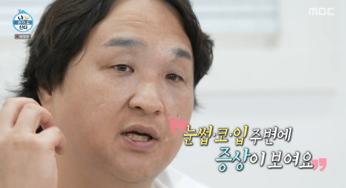 Composition, intractable disease, vitiligo, serious skin condition. It spreads as much as fat