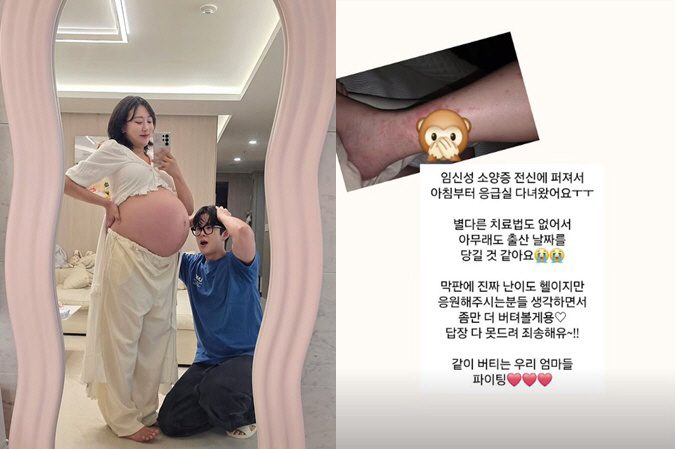 Twin Pregnancy Imra performed emergency for gestational pruritus...an advancement in childbirth