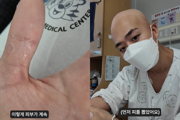 Cha Hyun-seung, a former Sunmi dancer, is battling leukemia. 'My skin is peeled off and my numbers are not going up.'