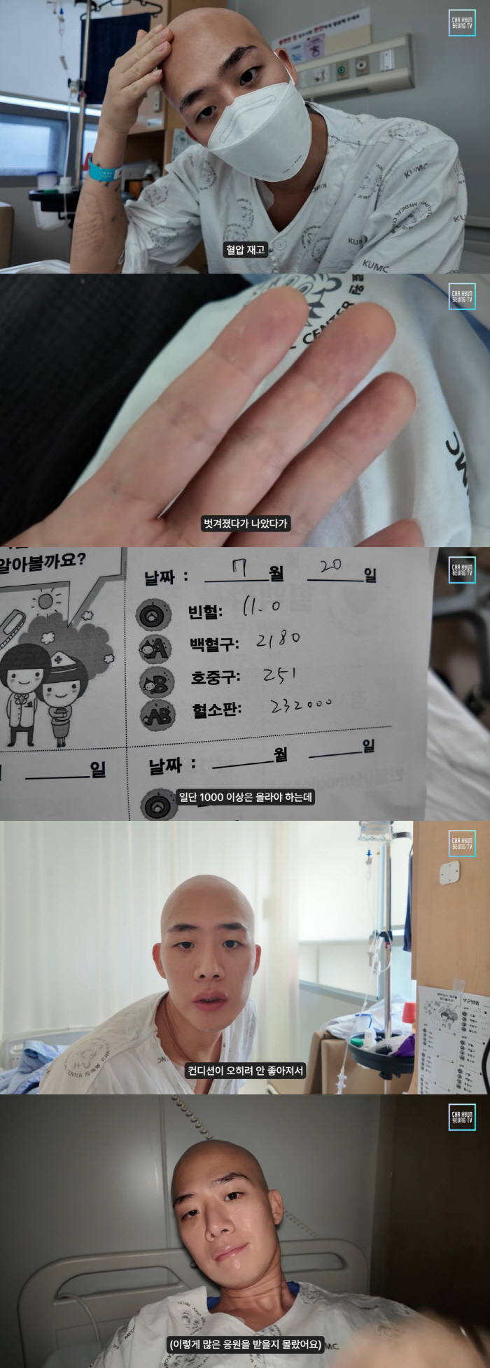 Cha Hyun-seung's skin is peeled off repeatedly..I have to go up, but I can't catch it