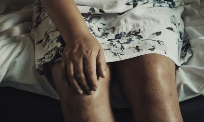 There's another reason to lose weight...The prevalence of knee arthritis, which is obese, is 1.8 times higher