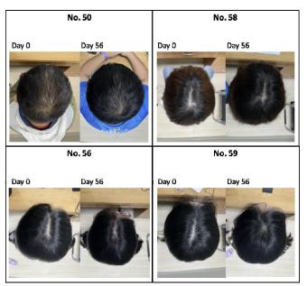 Full hair in 8 weeks...Will there be a new hope for hair loss people?