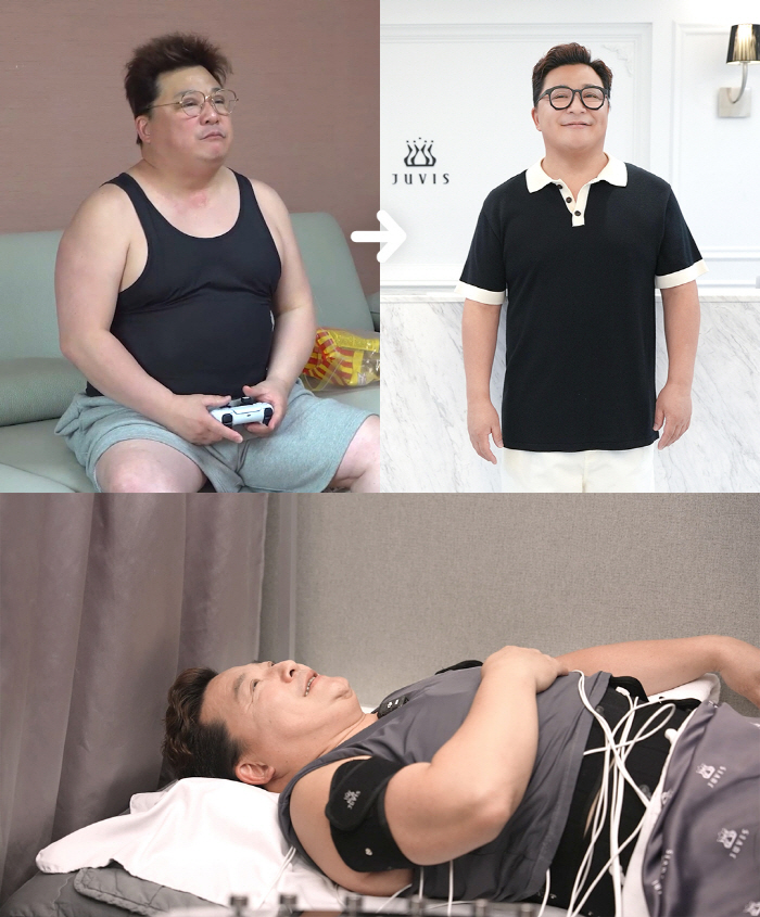Yoon Jung-soo, 105kg, confessed the side effects of liposuction, lost to 89kg, making his stomach soft