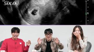 The 28th 'Nasol' has never happened before...'Pregnancy Ultrasound' is revealed during the broadcast