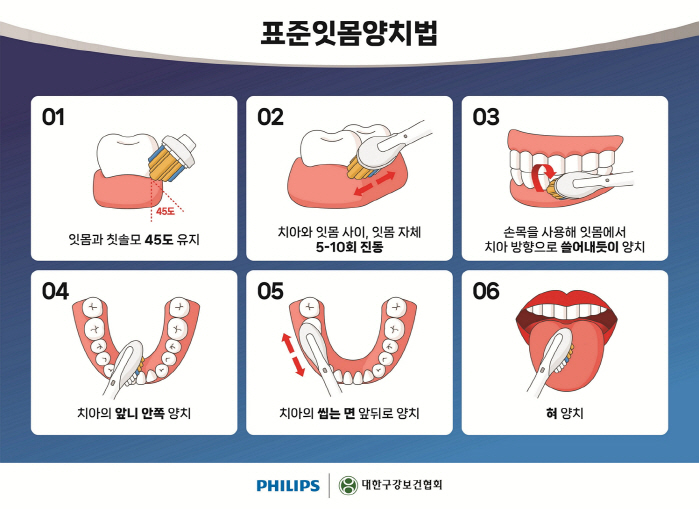 The higher the gingivitis index, the risk of breast cancer ↑…You need to prevent gum disease by brushing your teeth properly