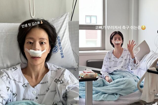 Lee Hyun-yi, a 'goal girl', fractured nose bone during a soccer game, 'I can't breathe' 