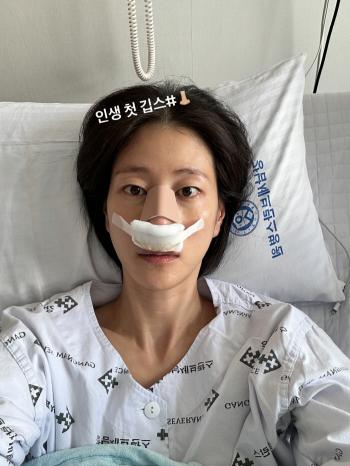 Lee Hyun-yi Reveals Nose Surgery Live...I'm back to my old nose