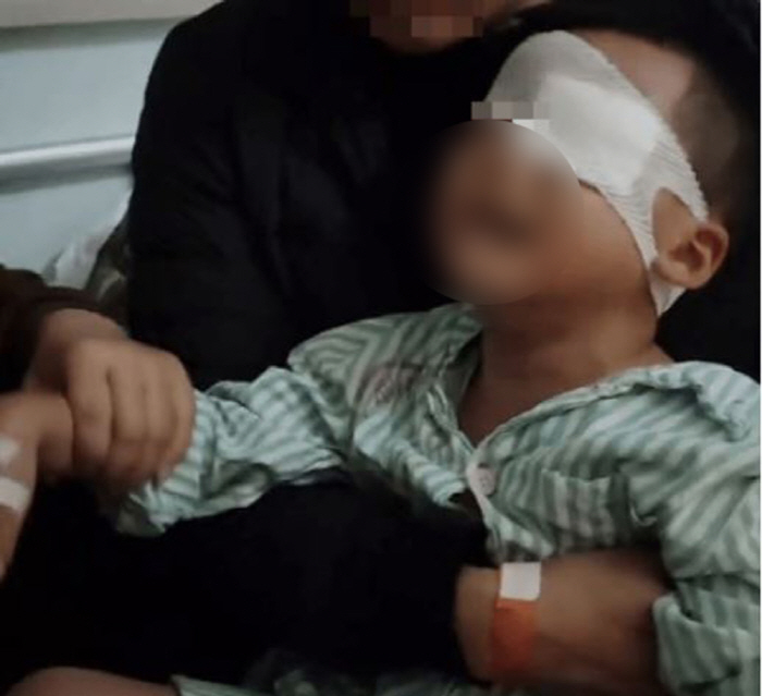I put pork oil on a kindergarten student with an injured eye, so I lost my sight...doubt about the teacher's qualifications